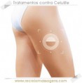 /album/servi%c3%a7os-oferecidos/celulite-jpg/